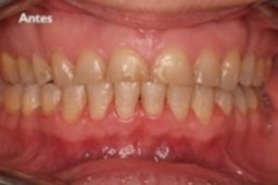 problema-dental-zaragoza-300x199.jpg